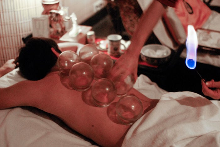 cupping massage china