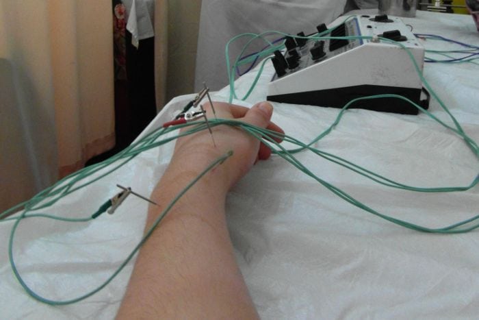 agopuntura cinese agopuntura cinese